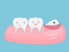 Wisdom teeth extraction